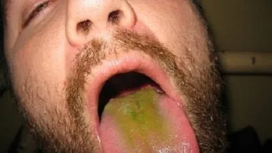 לשון ירוקה