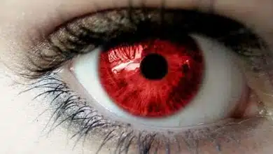 עיניים אדומות מריחואנה