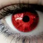 עיניים אדומות מריחואנה