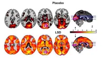 תחת השפעת ה-LSD, המוח האנושי מראה פעילות מוגברת של עשרות אחוזים לעומת המצב הרגיל. (מחקר חדש מראה: כך נראה "טריפ" של LSD במוח)