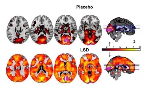 תחת השפעת ה-LSD, המוח האנושי מראה פעילות מוגברת של עשרות אחוזים לעומת המצב הרגיל. (מחקר חדש מראה: כך נראה "טריפ" LSD במוח)