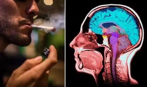 ערבוב קנאביס וטבק גורם להשפעה על הזיכרון - שעדיין אינה מובנת במלואה