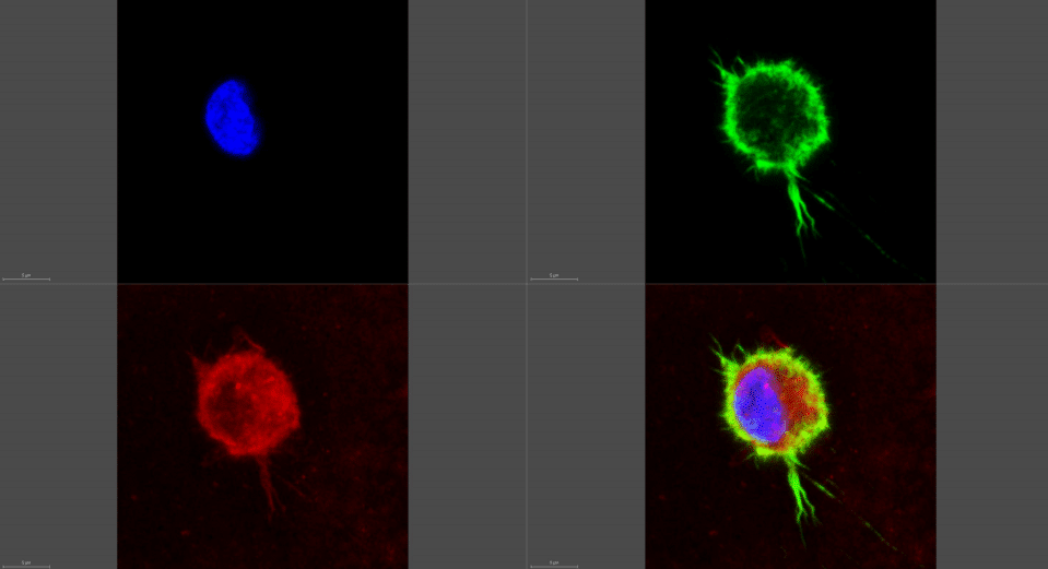 תמונה מיקרוסקופית של תא מקרופאג' (צילום: אדי בלאוסוב, מכון וולקני. בכחול: גרעין התא, באדום: שלד התא, ובירוק: ממברנת התא)