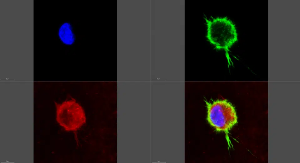 תמונה מיקרוסקופית של תא מקרופאג' (צילום: אדי בלאוסוב, מכון וולקני. בכחול: גרעין התא, באדום: שלד התא, ובירוק: ממברנת התא)