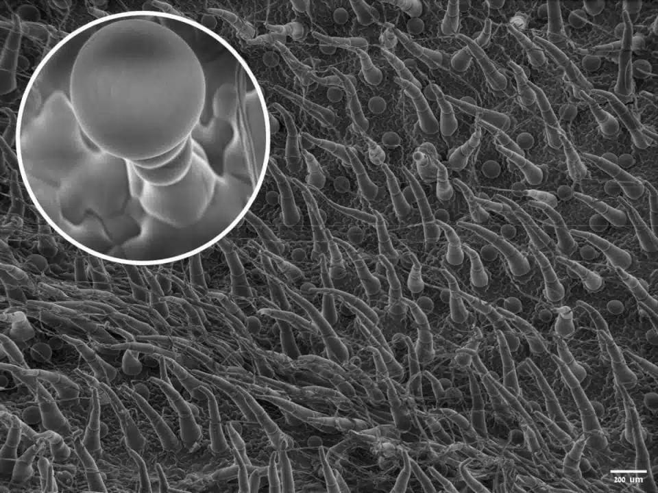 צילום מקרוב של הטריכומות שמכסות את צמח המטרייה הצמרירית מתחת לעדשת מיקרוסקופ (צילום: מתוך המחקר) 